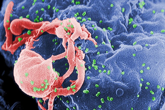 Scanning electron micrograph of HIV-1 budding (in green) from cultured lymphocyte. This image has been colored to highlight important features; see PHIL 1197 for original black and white view of this image. Multiple round bumps on cell surface represent sites of assembly and budding of virions.