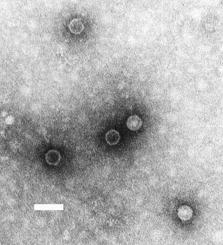 Polio virus.